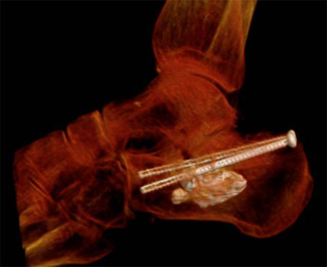 Figure 6