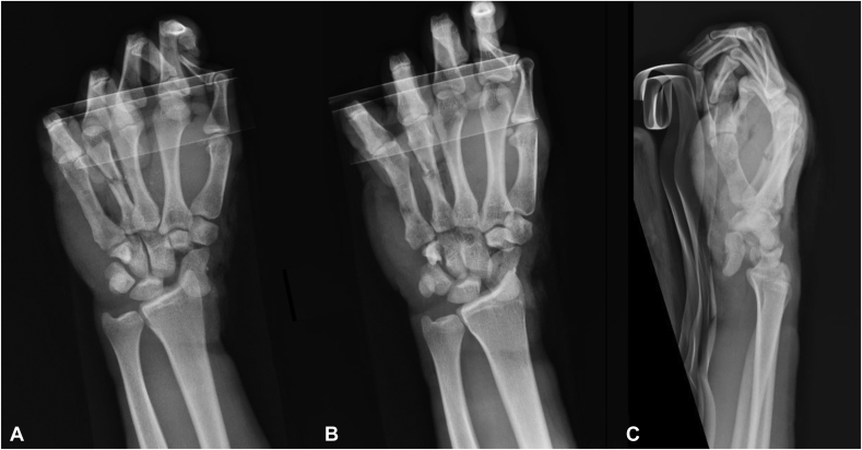 Figure 2
