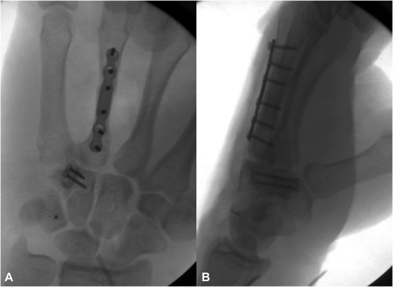 Figure 5