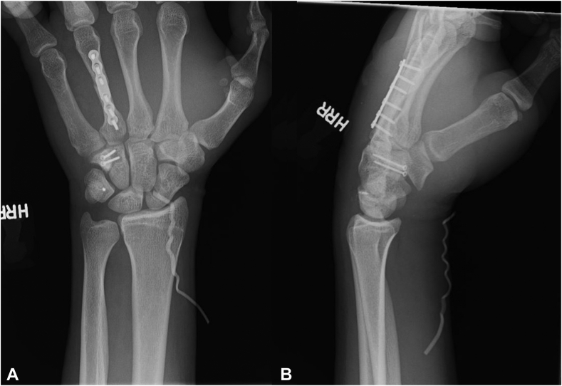 Figure 6
