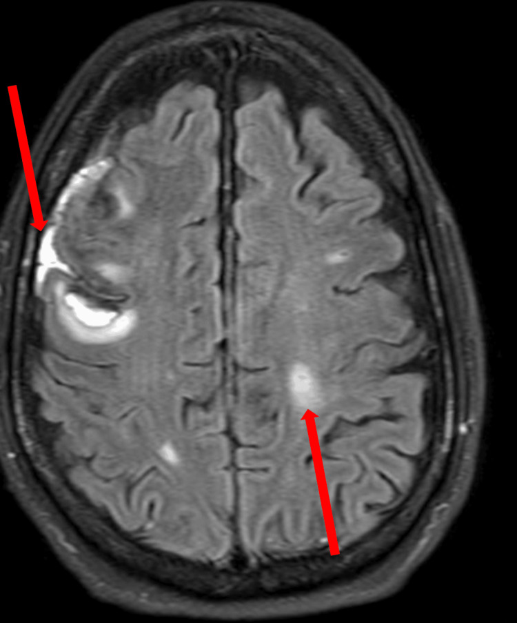 Figure 9