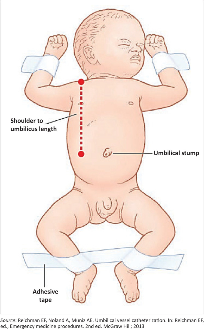 FIGURE 4