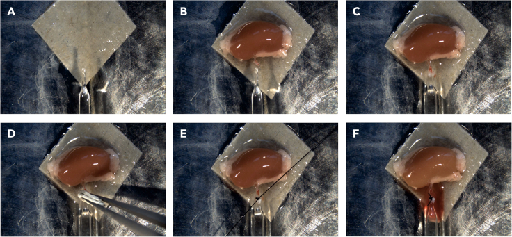Figure 6
