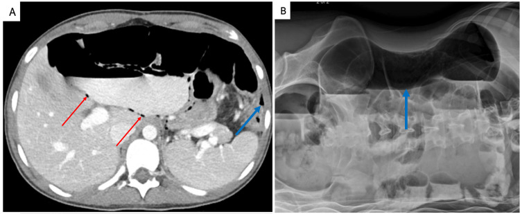 Figure 6
