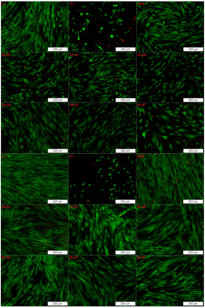 Figure 11