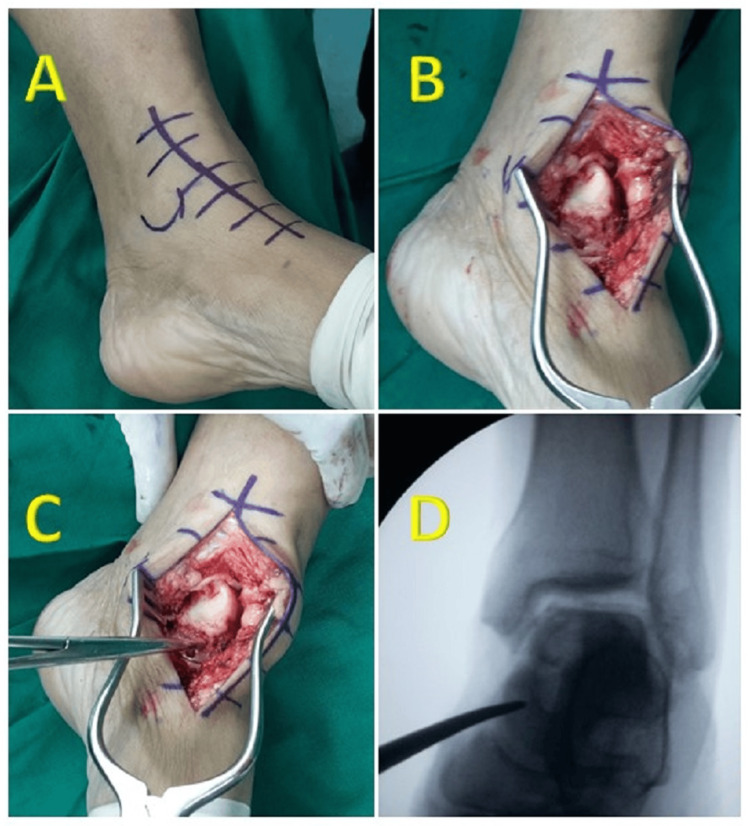 Figure 2