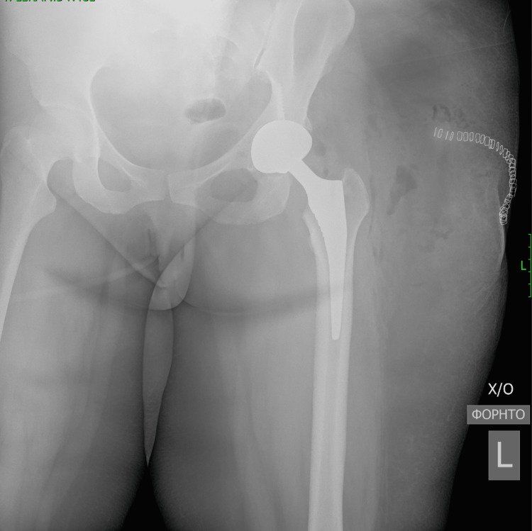 Figure 11