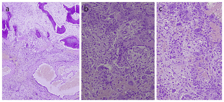 Figure 12