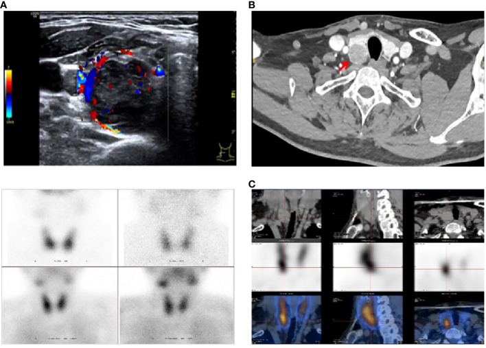 Figure 2