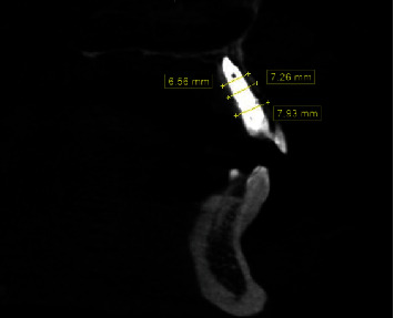 Figure 14