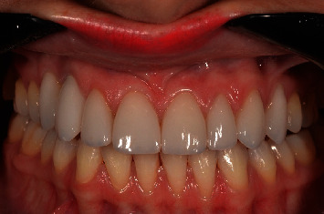 Figure 15