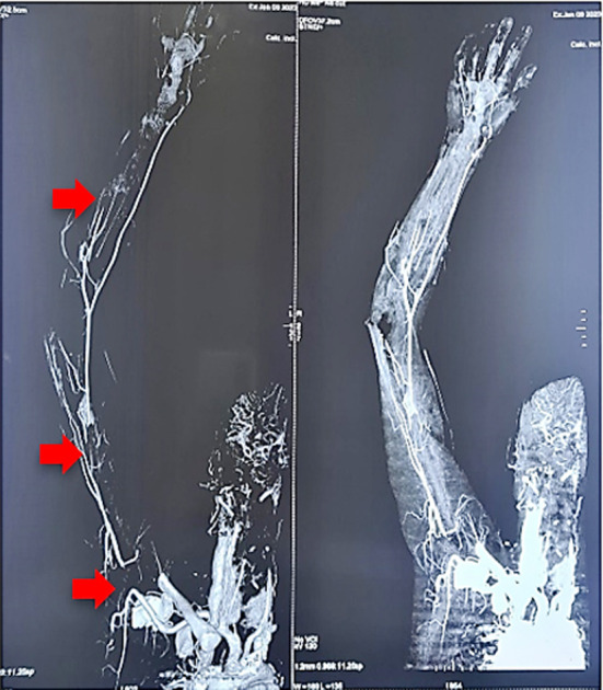 Fig.1