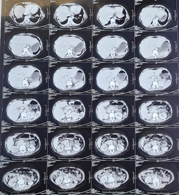 Fig.2