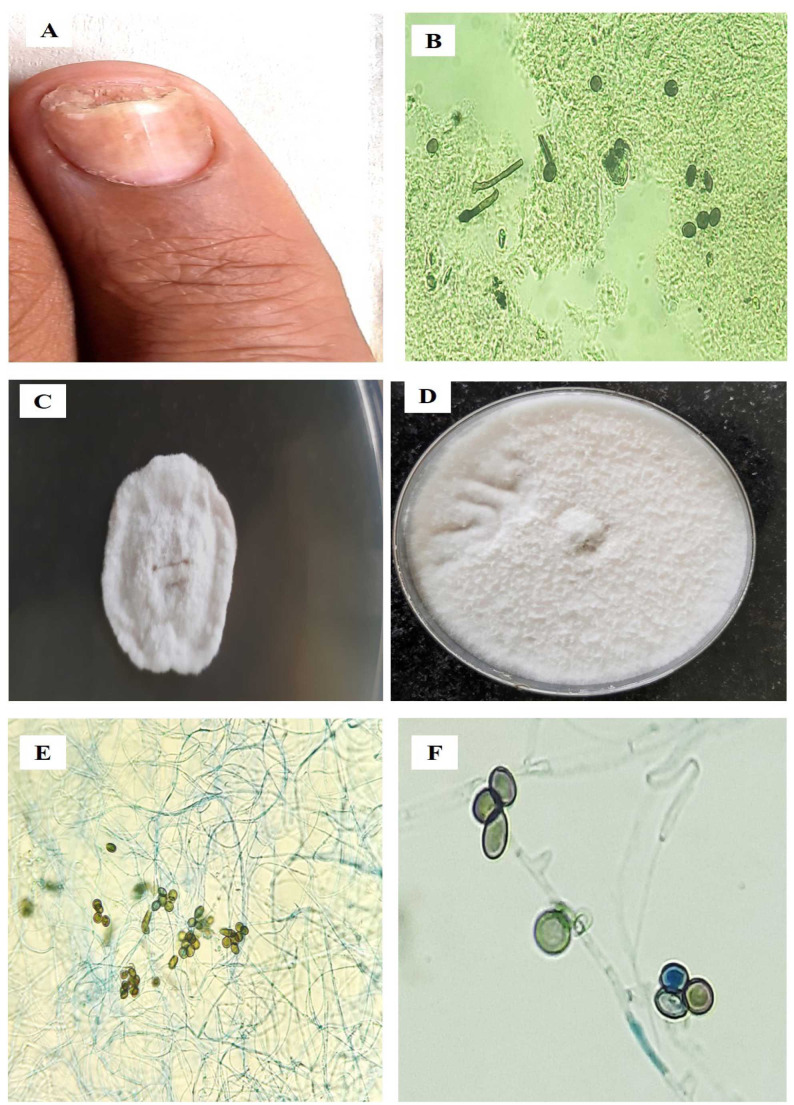 Figure 2.1