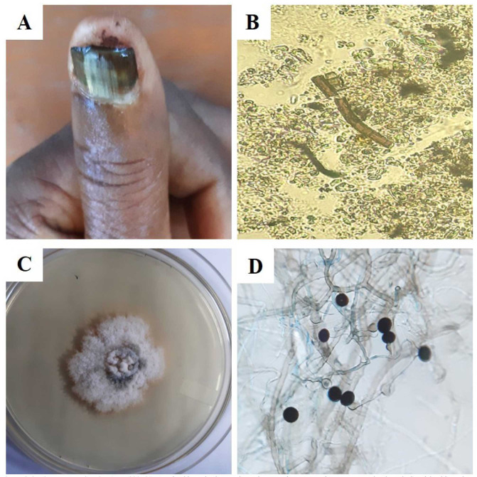 Figure 2.4