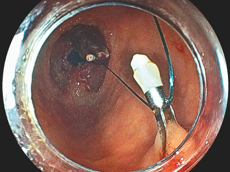 Fig. 4