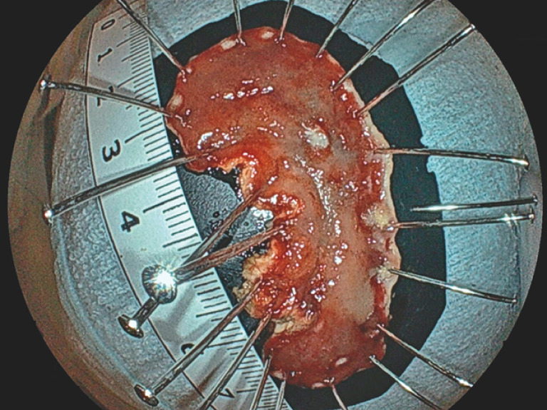 Fig. 5