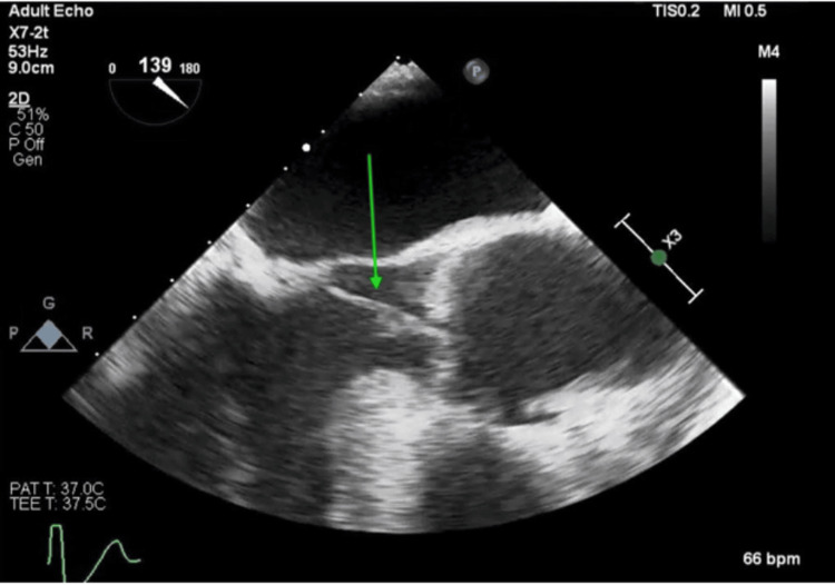 Figure 5