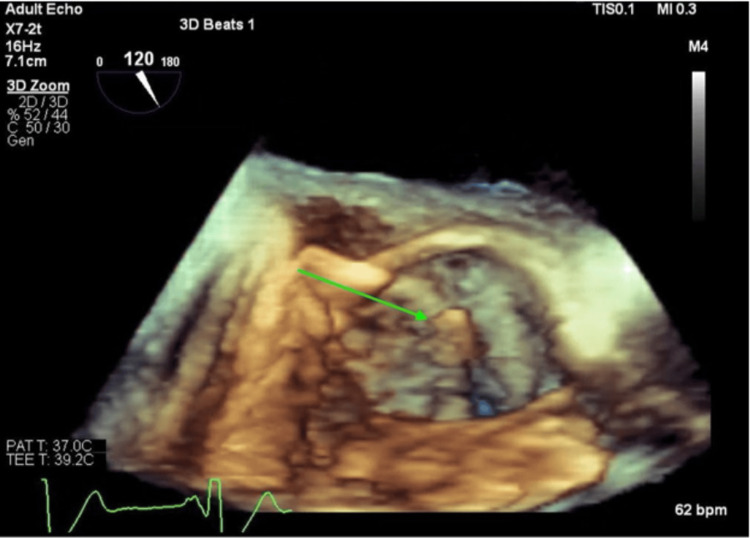 Figure 6