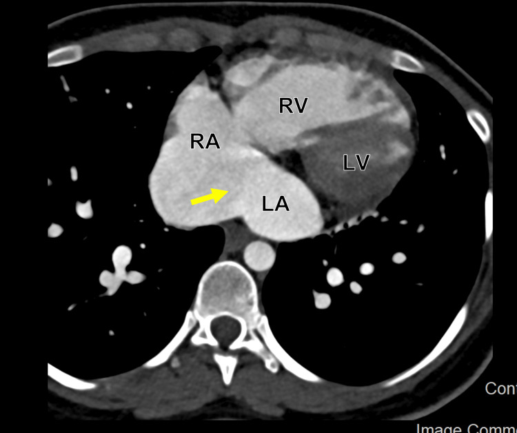 Figure 9