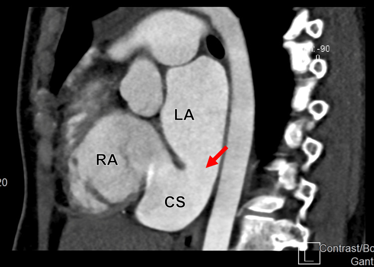 Figure 10