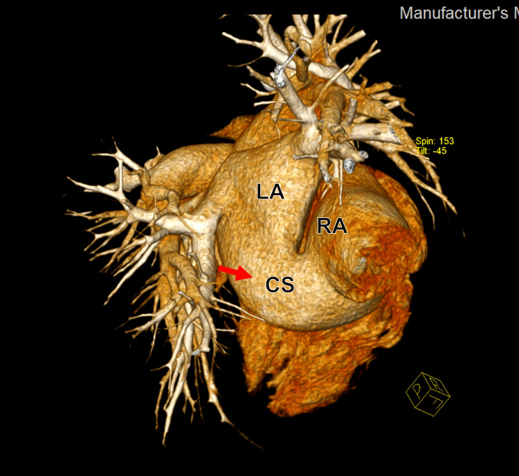 Figure 12