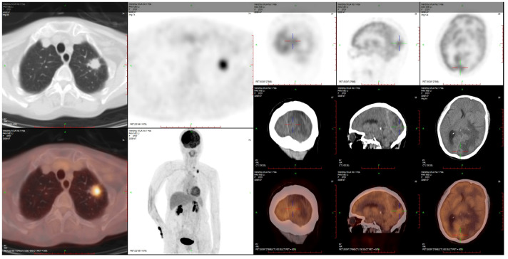 Figure 3