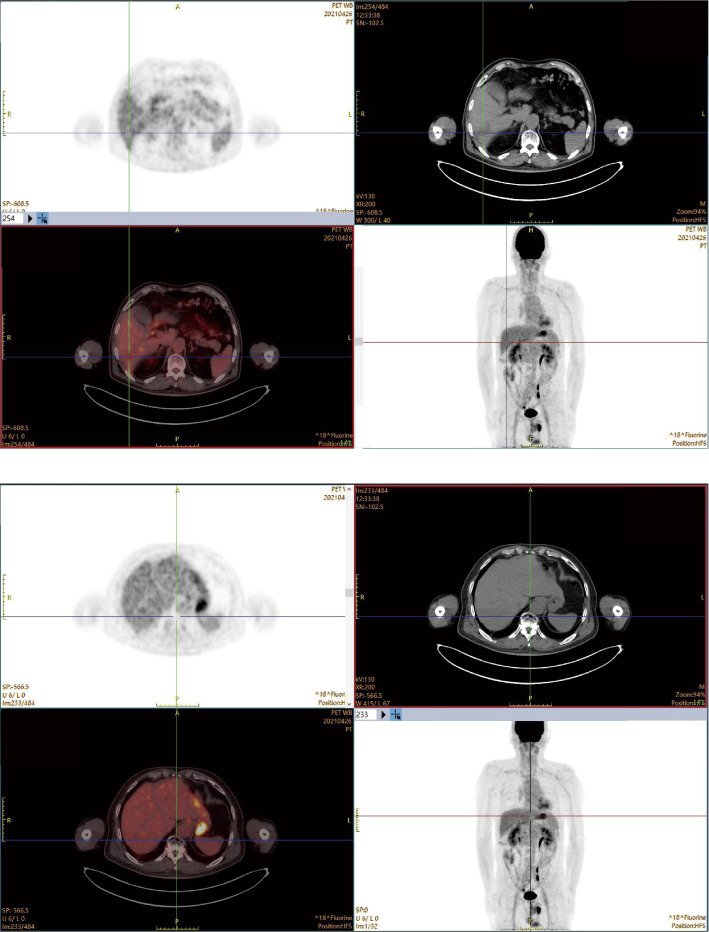 Figure 4