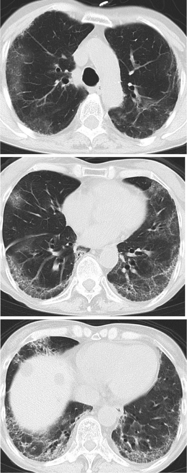 FIGURE 3