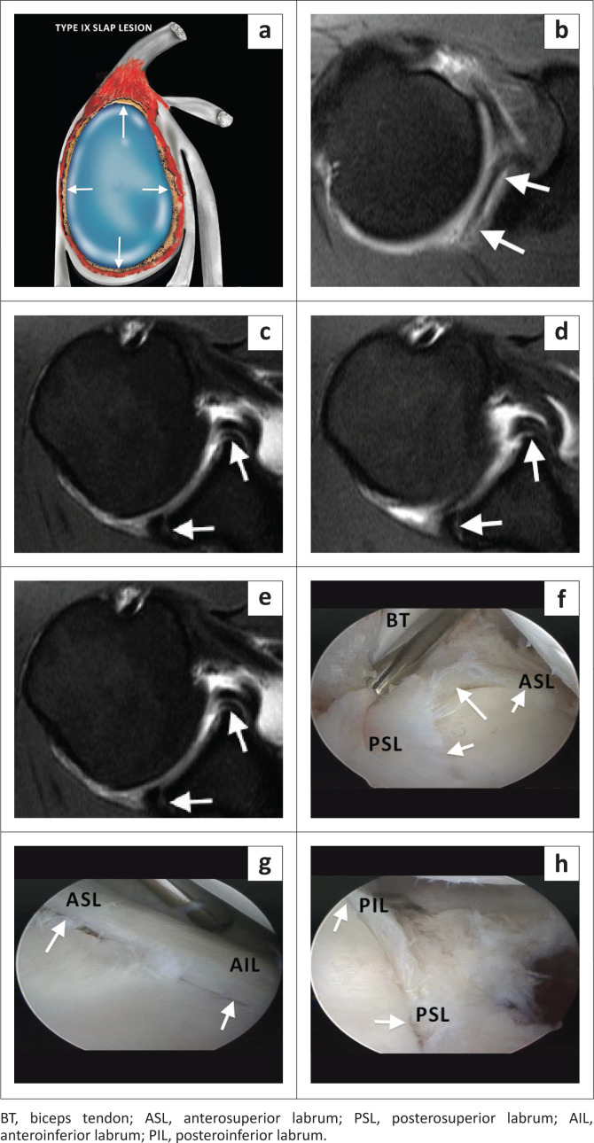 FIGURE 14