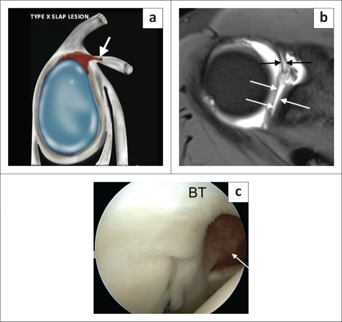 FIGURE 15