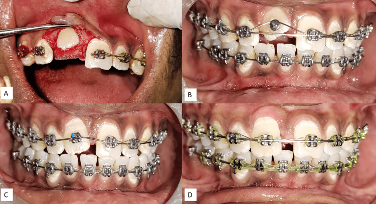 Figure 5