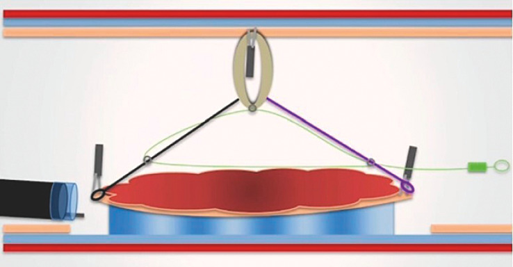 Fig. 1