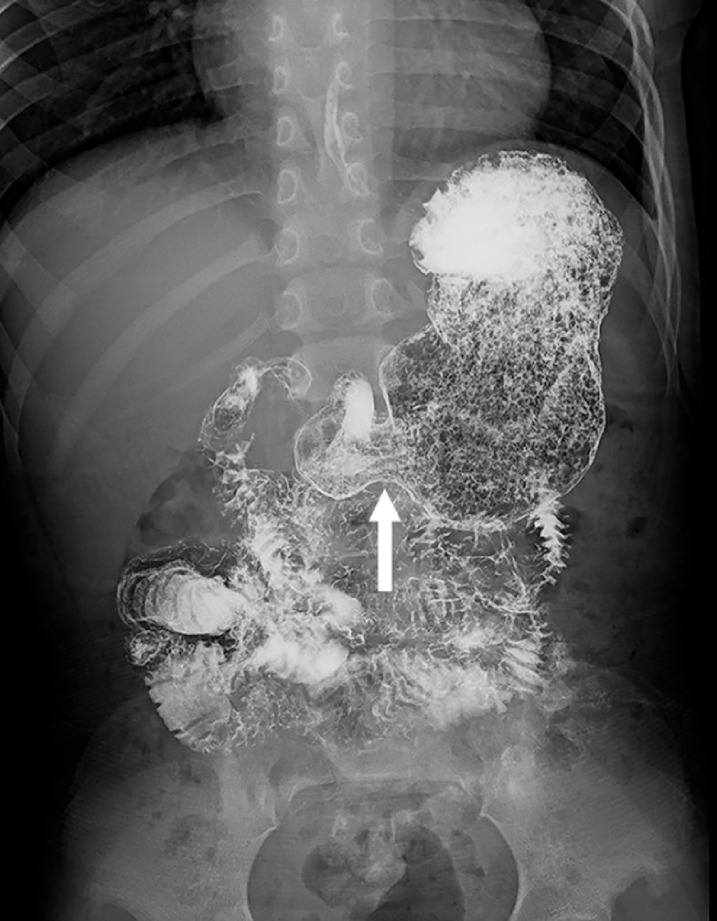 Fig. 2