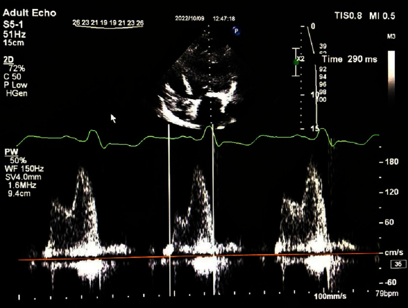 Figure 1a