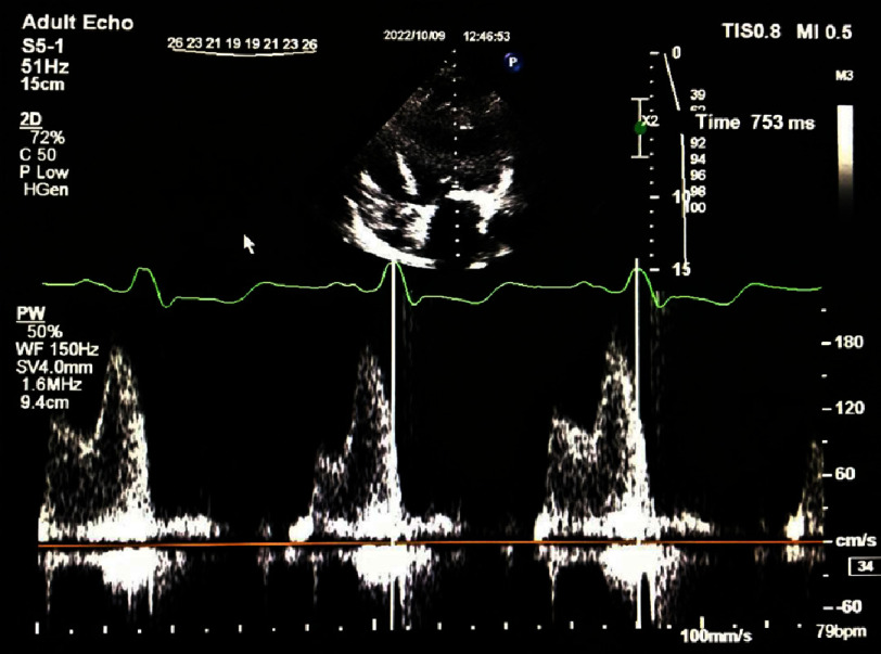 Figure 1b