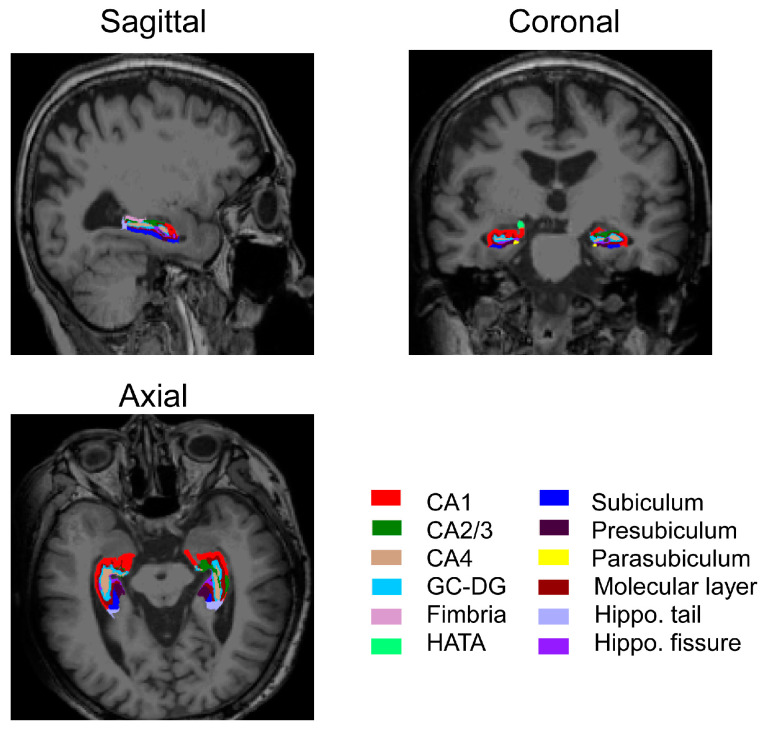 Figure 2