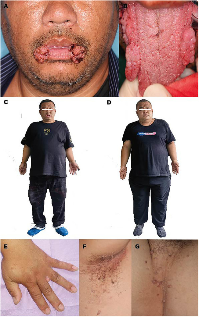 Figure 1