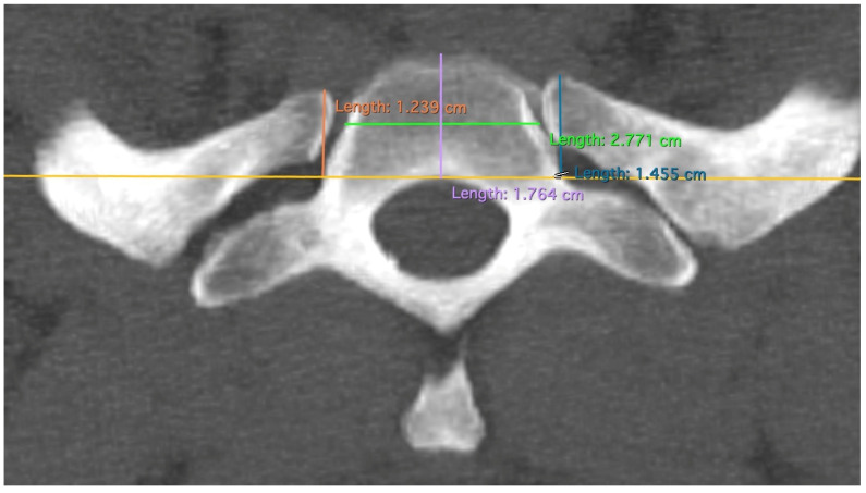 Figure 4