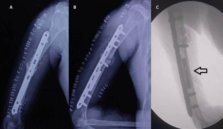 Figure 11