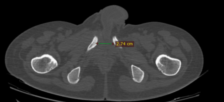 Figure 9