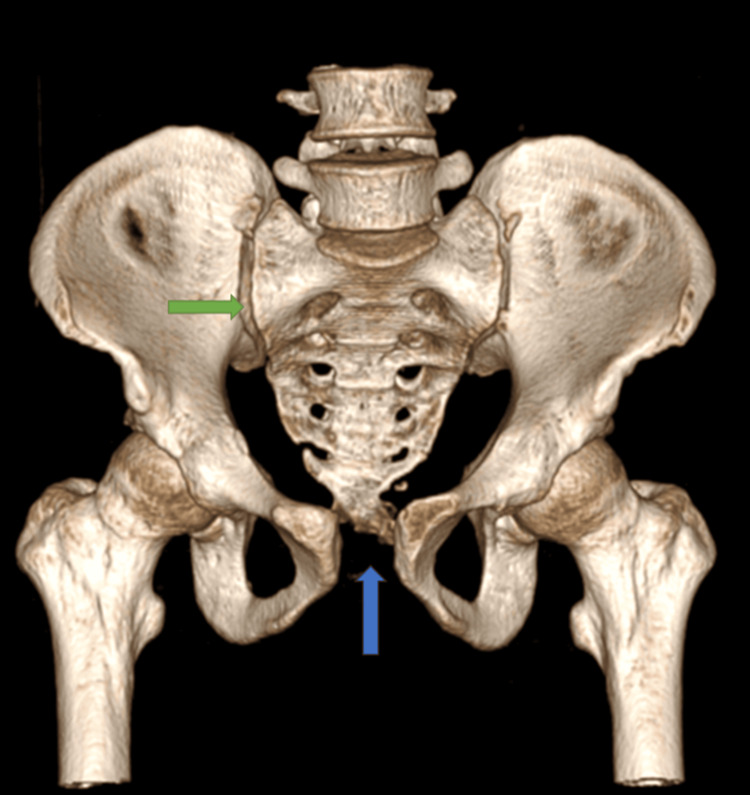 Figure 11