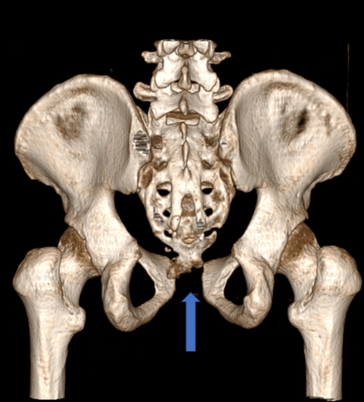 Figure 12