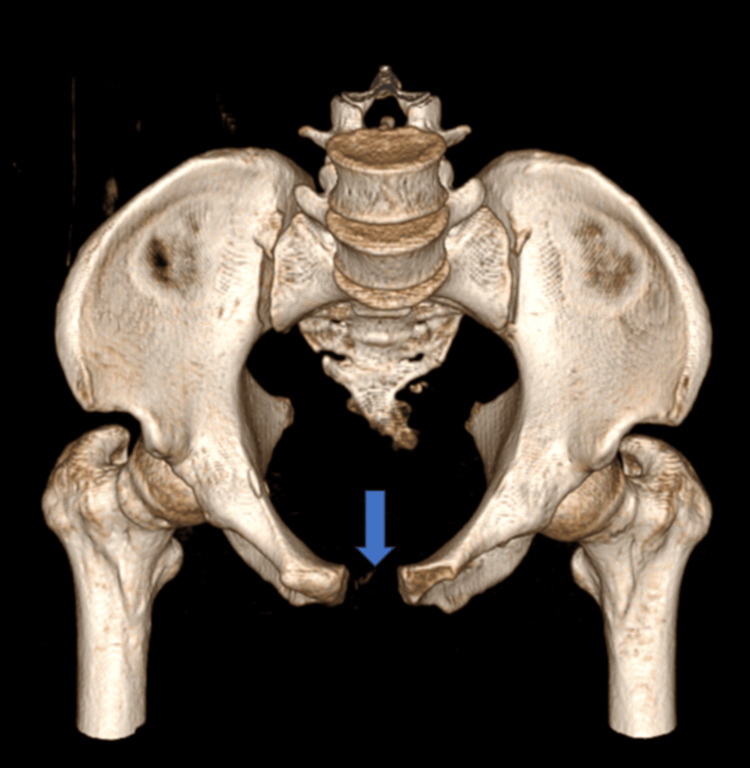 Figure 13