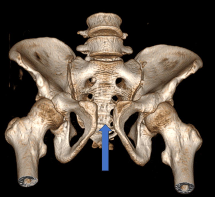 Figure 14