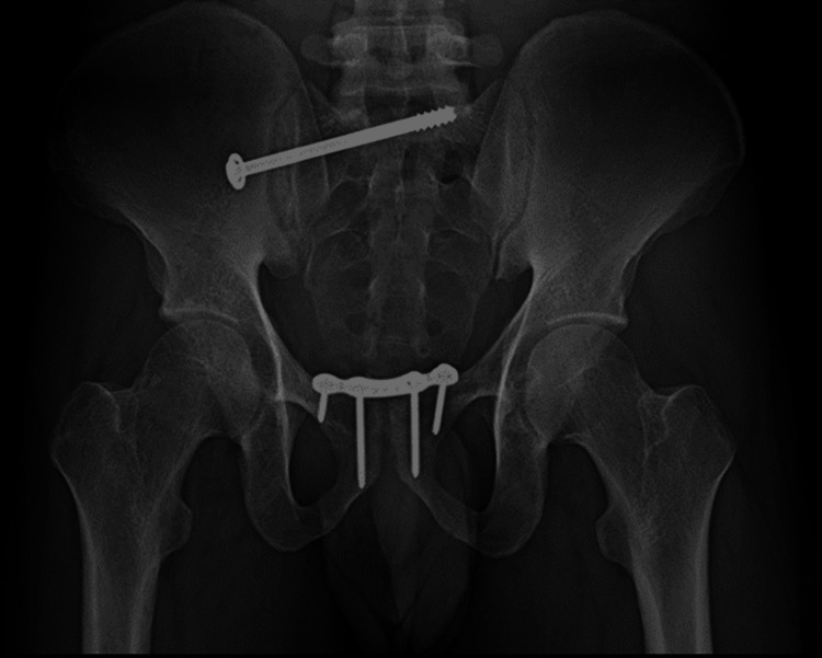 Figure 16