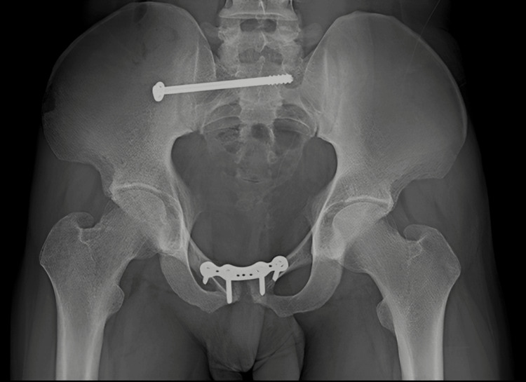 Figure 17