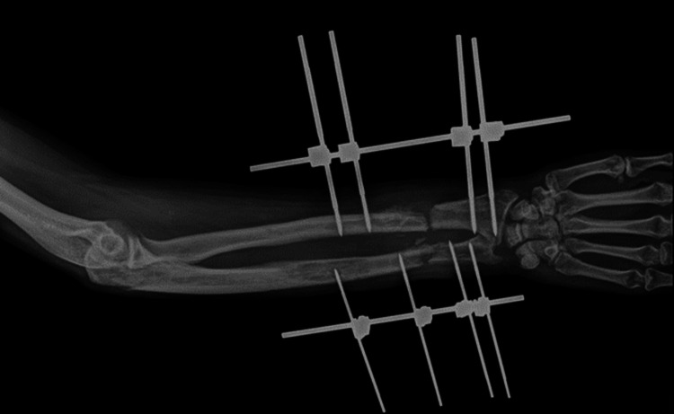 Figure 18