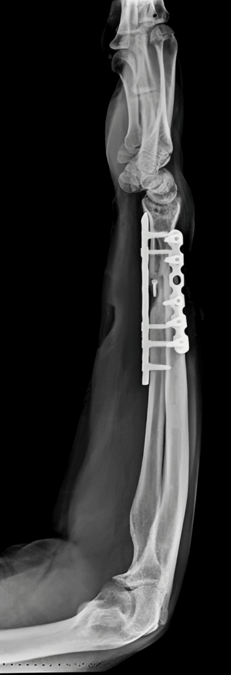 Figure 20