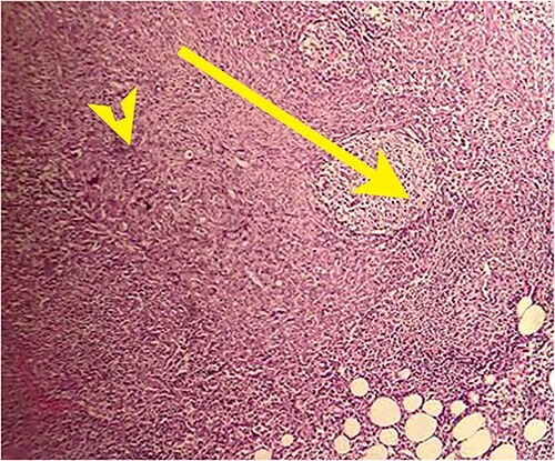 Figure 9